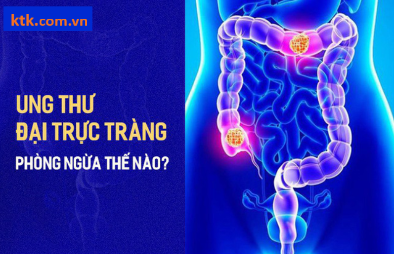 Phòng bệnh ung thư đại trực tràng: Quan trọng nhất là chế độ ăn uống và lối sống.