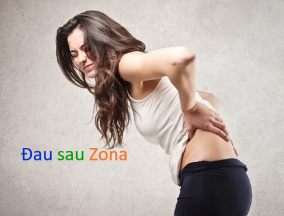 Điều trị đau dây thần kinh sau Zona.